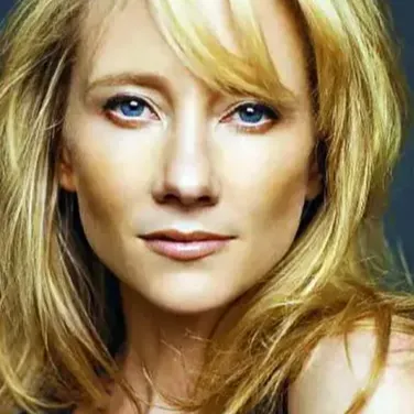 Anne Heche has herpes