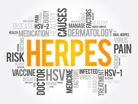 herpes support and tips